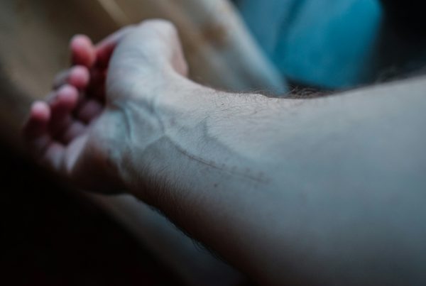 vein symptoms