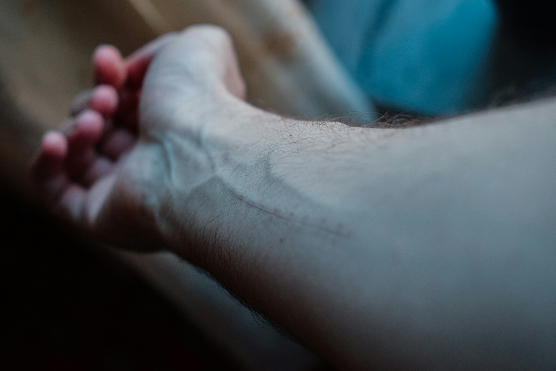 Vein Problem Symptoms: Aches, Heaviness, Itching, Skin Changes, What to Track