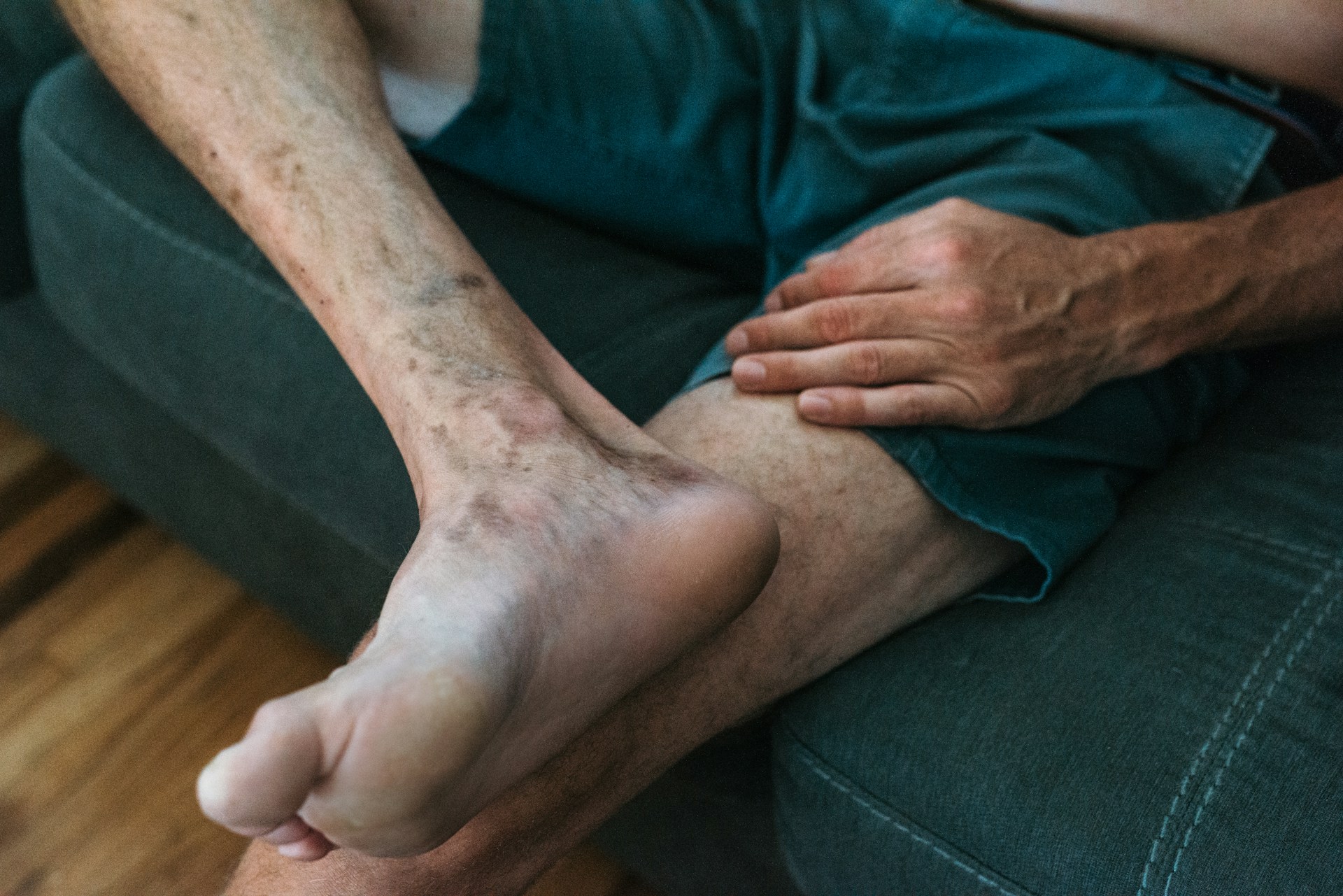 Understanding Non-Surgical Varicose Vein Removal Options